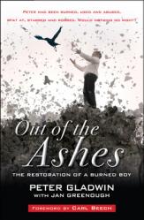  Out of the Ashes: The Restoration of a Burned Boy 